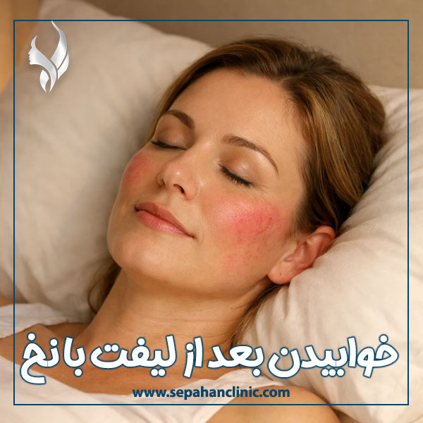 خوابیدن بعد از لیفت با نخ + کلینیک زیبایی سپاهان