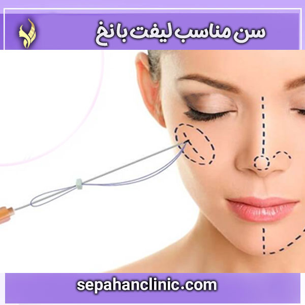 سن مناسب لیفت با نخ ، کلینیک سپاهان در اصفهان