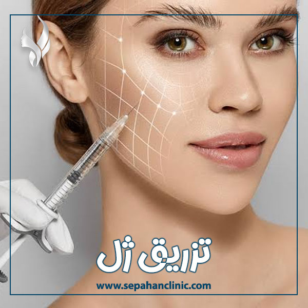 تزریق ژل در اصفهان + کلینیک سپاهان