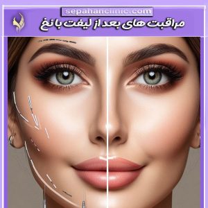 تفاوت های لیفت با نخ و جراحی زیبایی از دکتر طالبی در کلینیک سپاهان