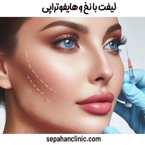 لیفت با نخ و هایفوتراپی از دکتر محمد طالبی در اصفهان