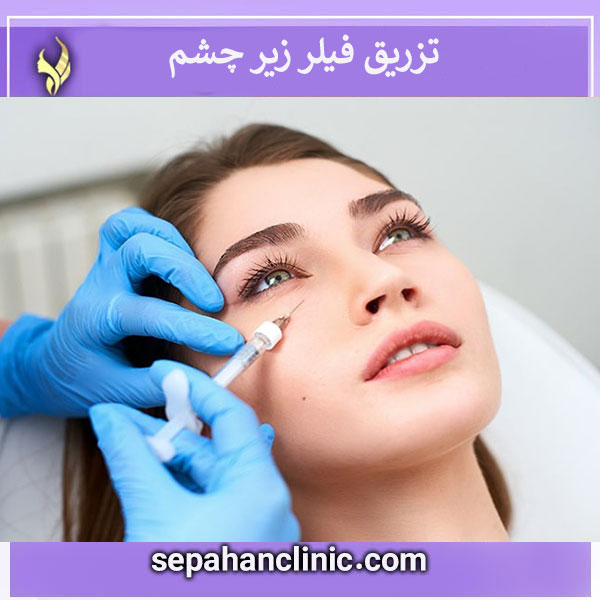 تزریق فیلر زیر چشم _ کلینیک سپاهان