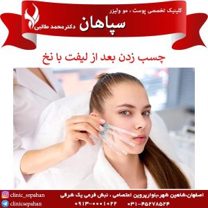 چسب زدن بعد از لیفت با نخ _ کلینیک سپاهان