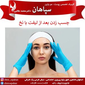 چسب زدن بعد از لیفت با نخ _ کلینیک سپاهان