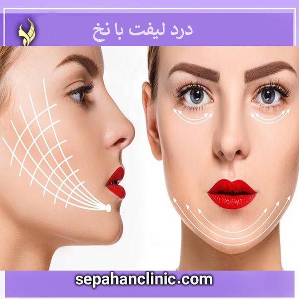 درد لیفت با نخ _ کلینیک سپاهان