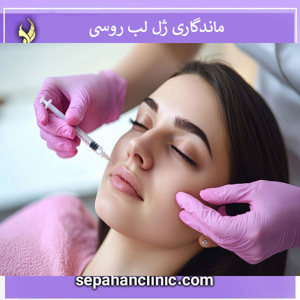 ماندگاری ژل لب روسی چقدر است ؟_ کلینیک سپاهان