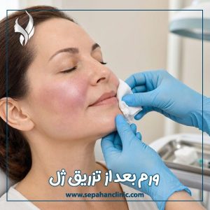 ورم بعد از تزریق ژل